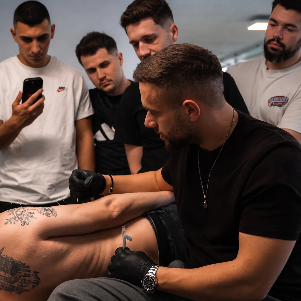 Demonstrație de dry needling pe musculatura spatelui
