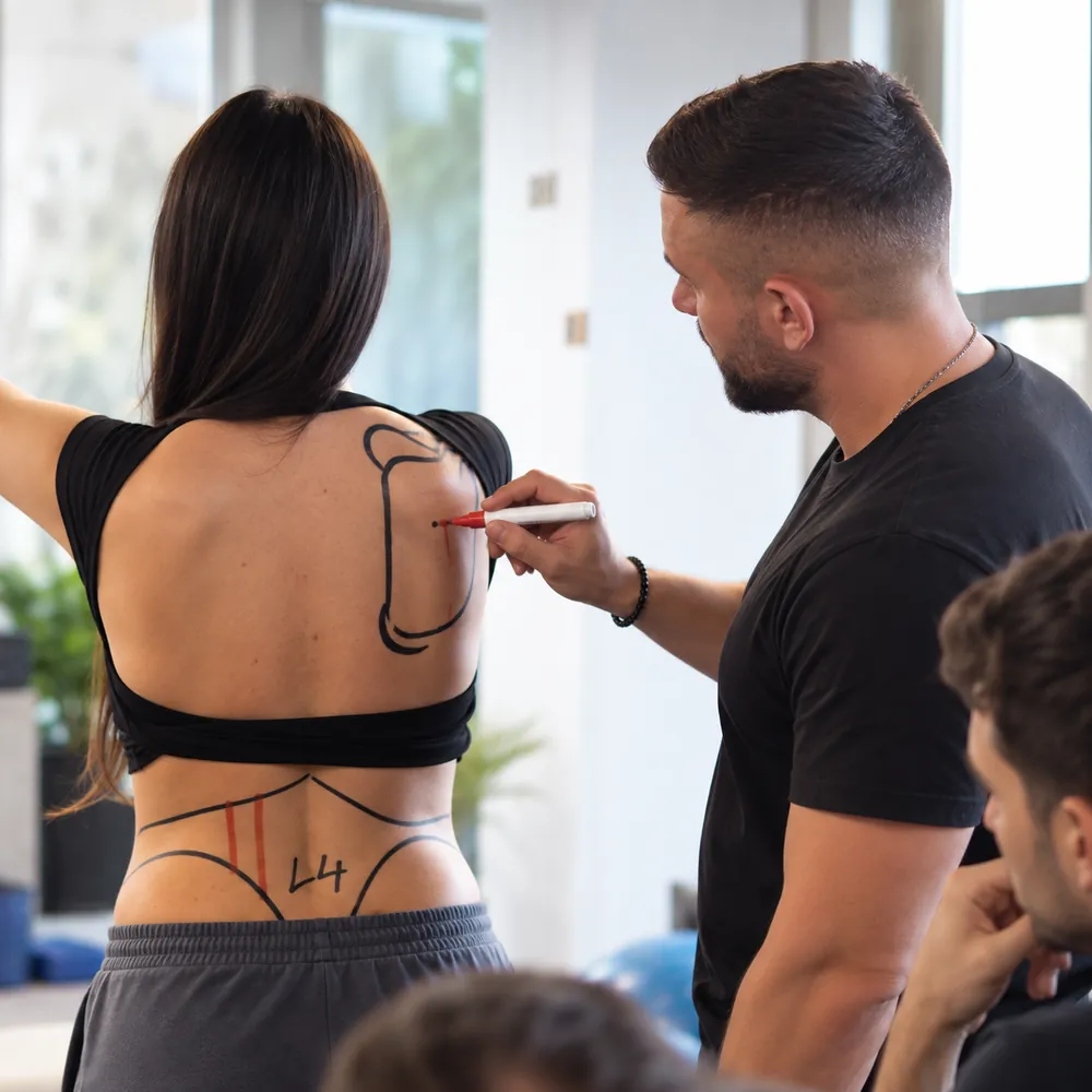 Marcarea zonelor de lucru pe spate înainte de dry needling